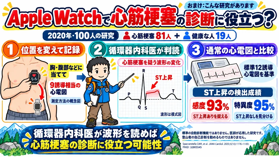 Apple Watchの心電図が心筋梗塞の診断に役立つかを調べた2020年の研究の図解。心筋梗塞81人と健康な人19人で、時計を胸や腹部に当てて9誘導相当の心電図を記録し、循環器内科医が判読した。ST上昇の検出は感度93%、特異度95%